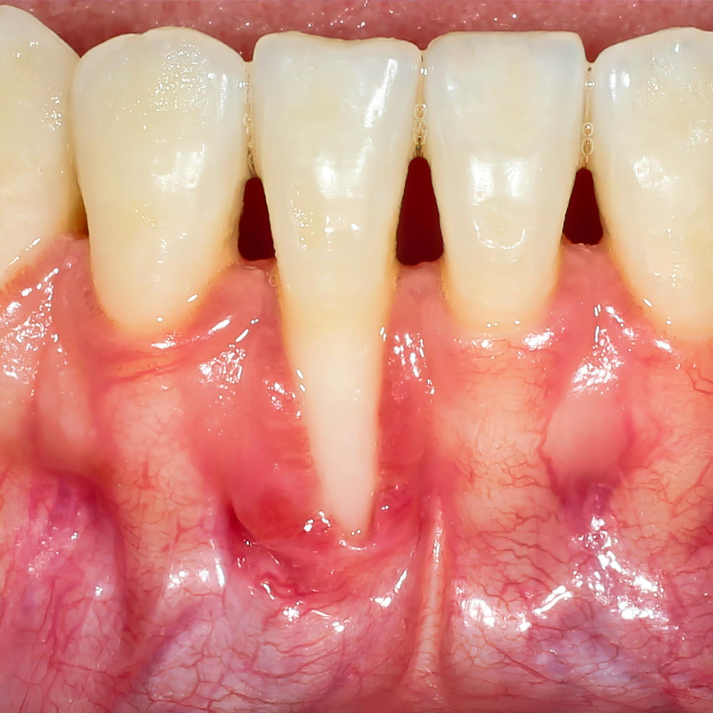 45375 Periodoncia - 3