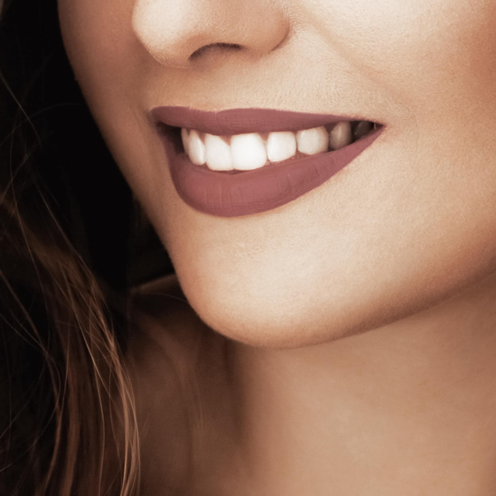 53406 Carillas de composite - 2