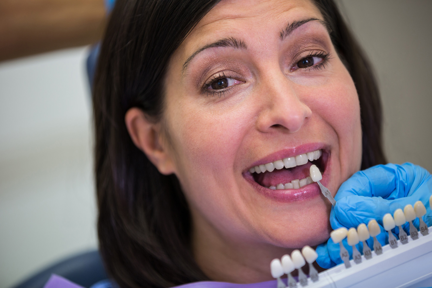 74151 Estética dental - 2