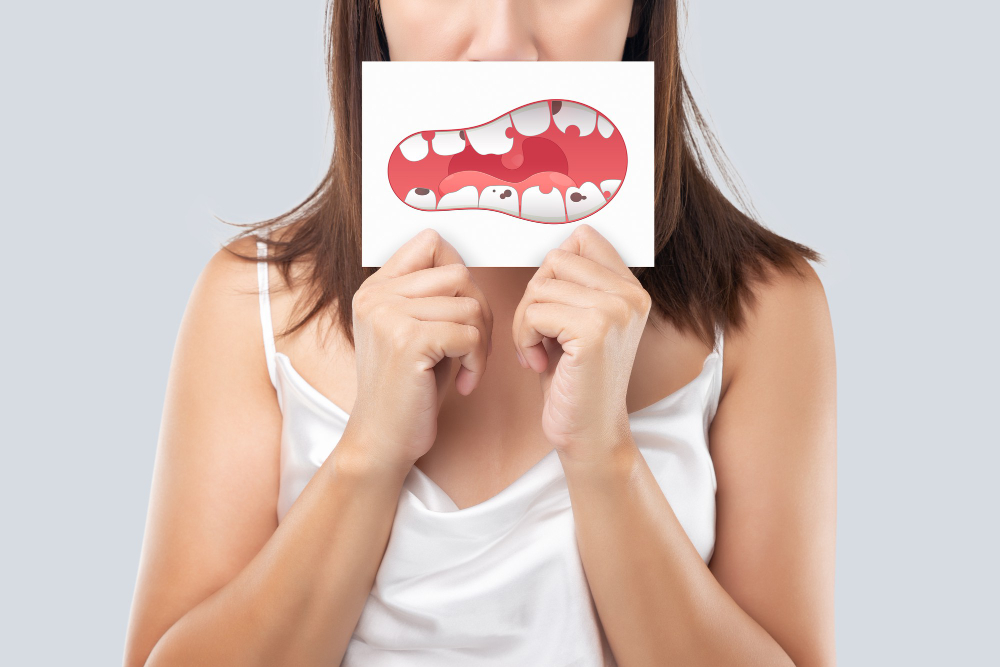 860 Periodontitis - 1