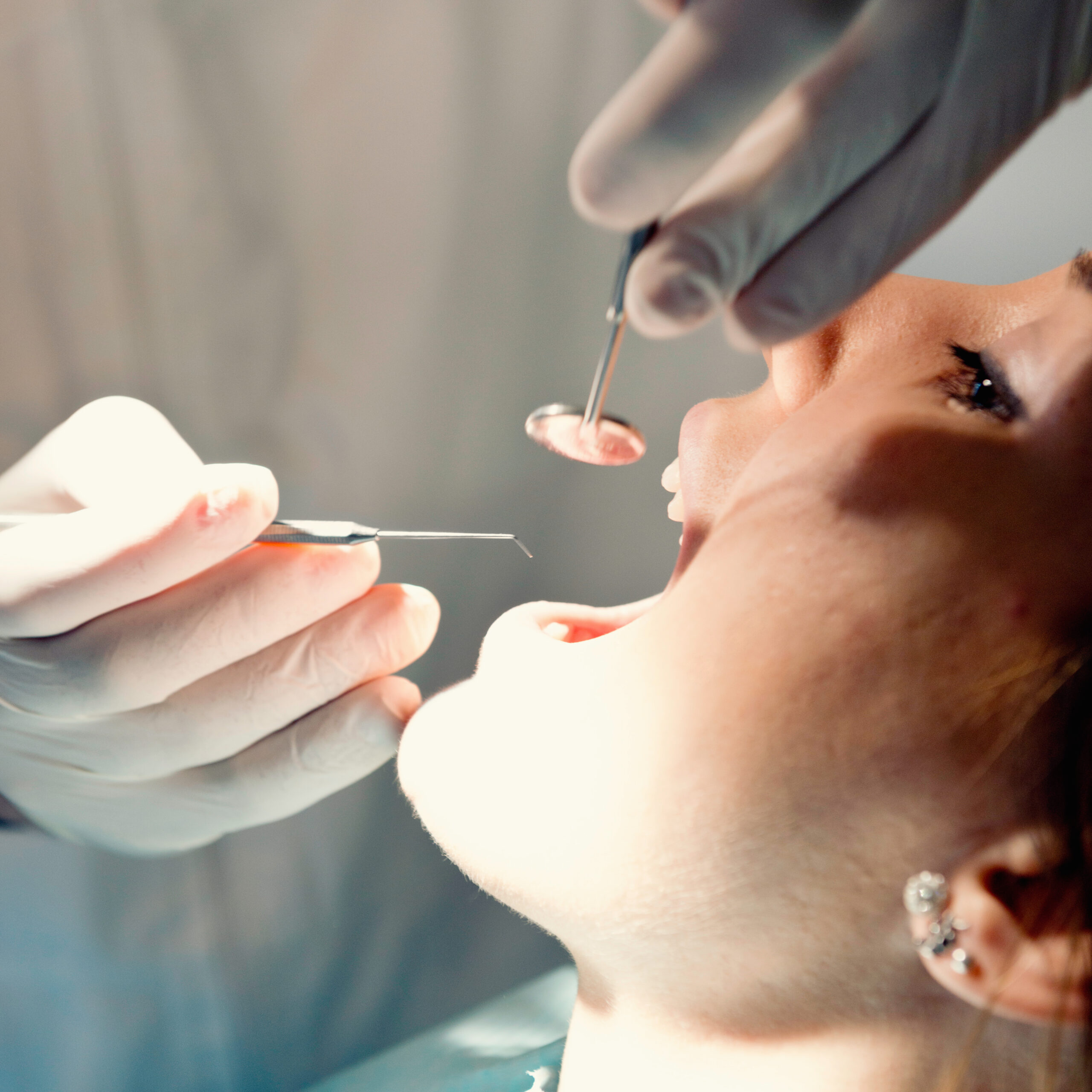 Regular dental check-up Extracciones - 3